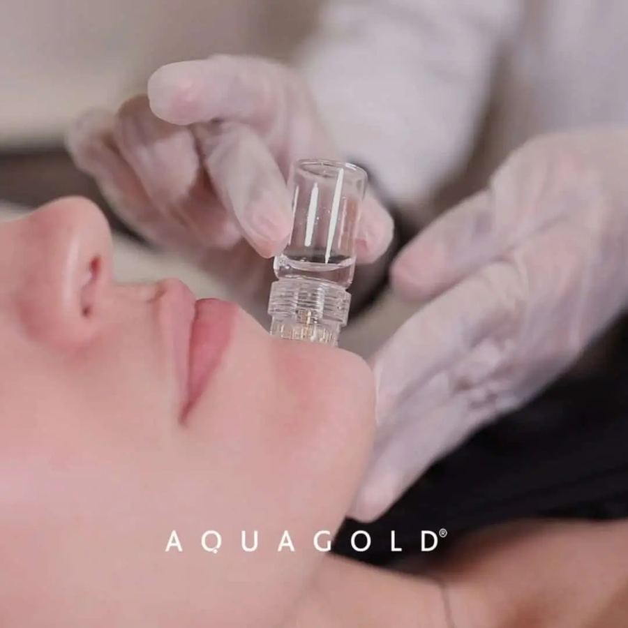 AquaGold Microneedling