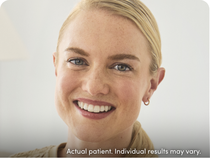 Patient featured on the official XEOMIN website; individual results may vary